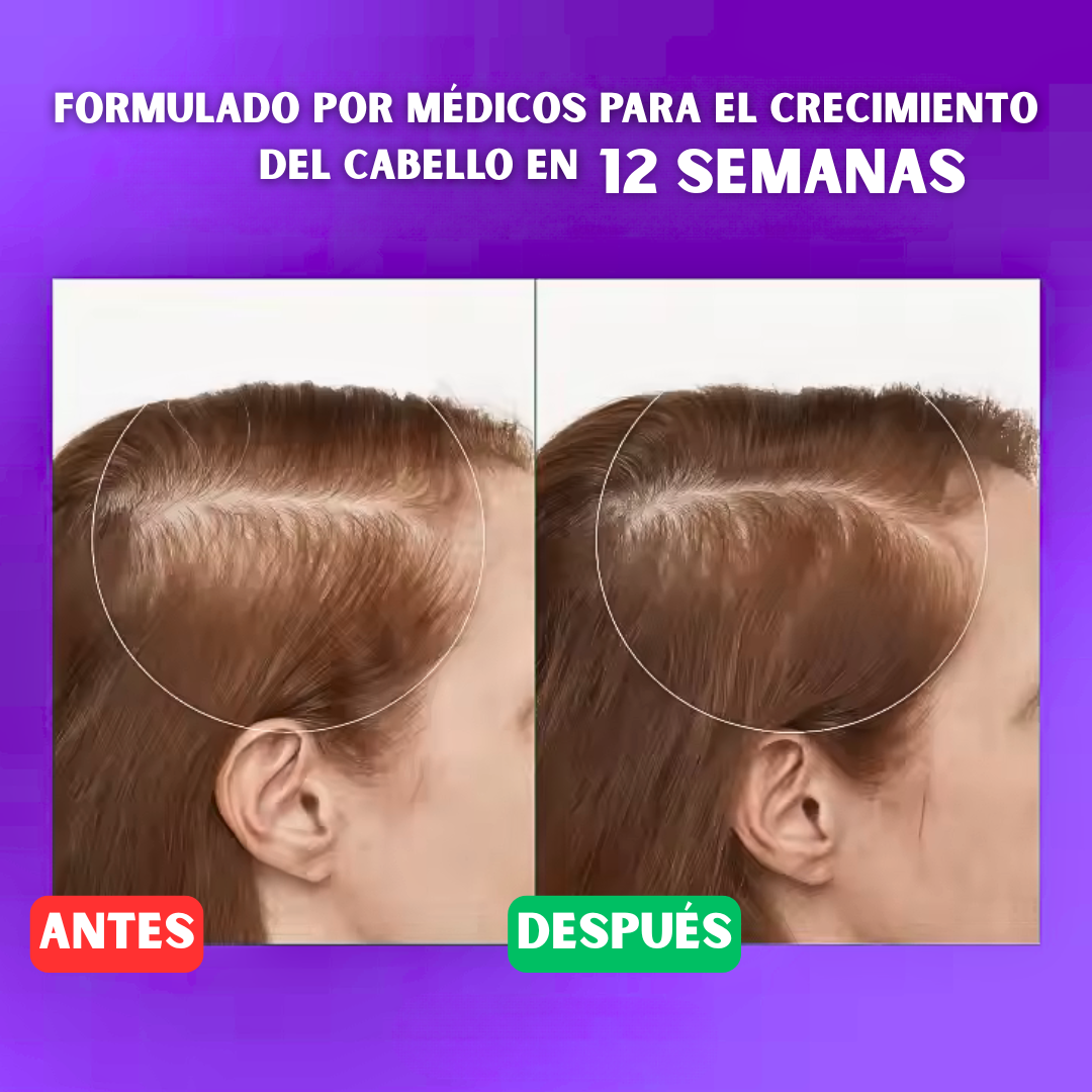 ✨RollGrow® Suero Capilar en Roll-On